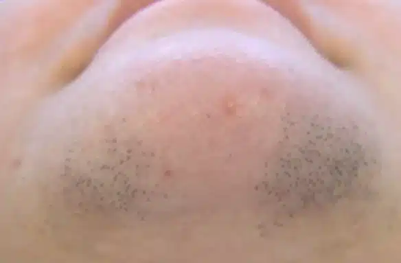 before_img